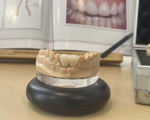 Soluciones protésicas a medida de tu clínica | Laboratorio ADOS