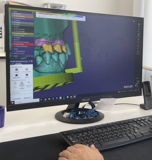 Soluciones protésicas a medida de tu clínica | Laboratorio ADOS