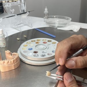 laboratorio dental en vigo laboratorio ADOS