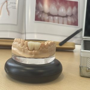laboratorio dental en vigo laboratorio ADOS
