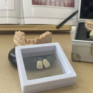 laboratorio dental en vigo laboratorio ADOS