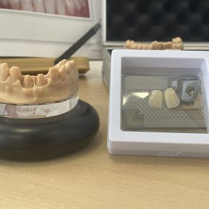 laboratorio dental en vigo laboratorio ADOS