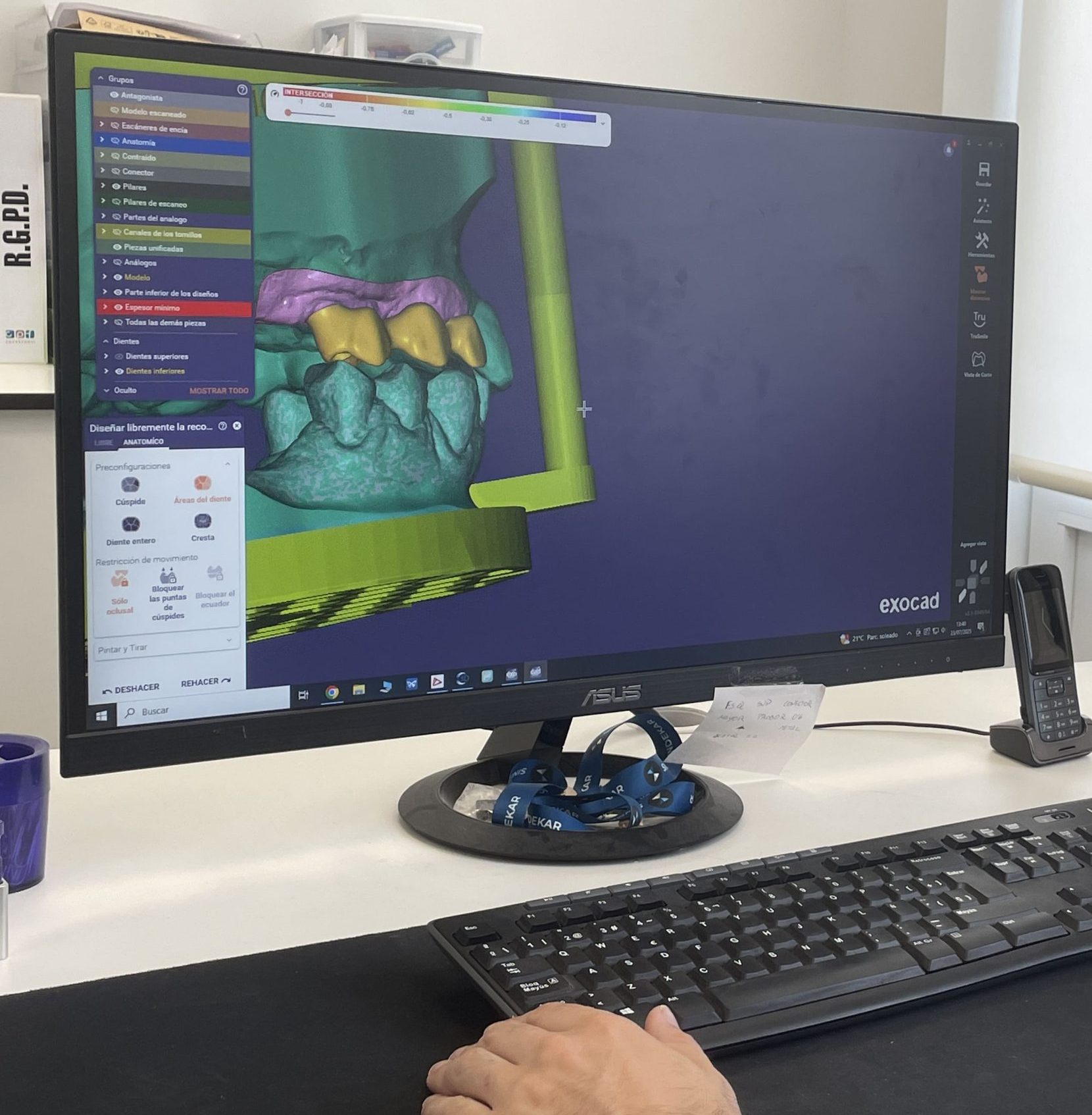 Soluciones protésicas a medida de tu clínica | Laboratorio ADOS